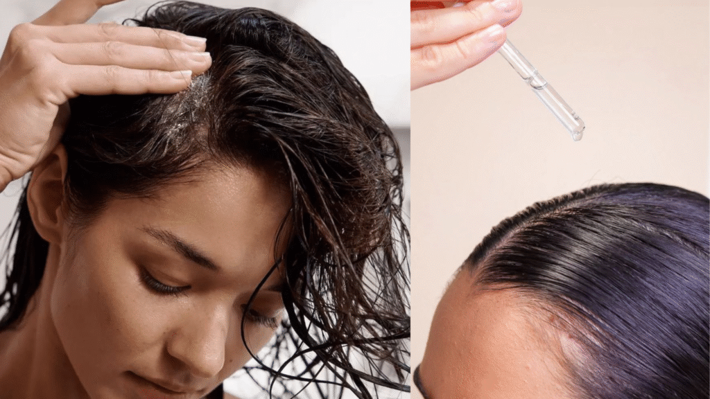 Você Sabe Cuidar do Seu Couro Cabeludo? Faça Isso para Cuidar Dele da Melhor Forma!