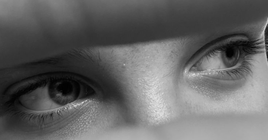 Eu Parei de Tratar Errado: Como Aprendi a Identificar a Real Causa das Minhas Olheiras (E Como Você Também Pode)