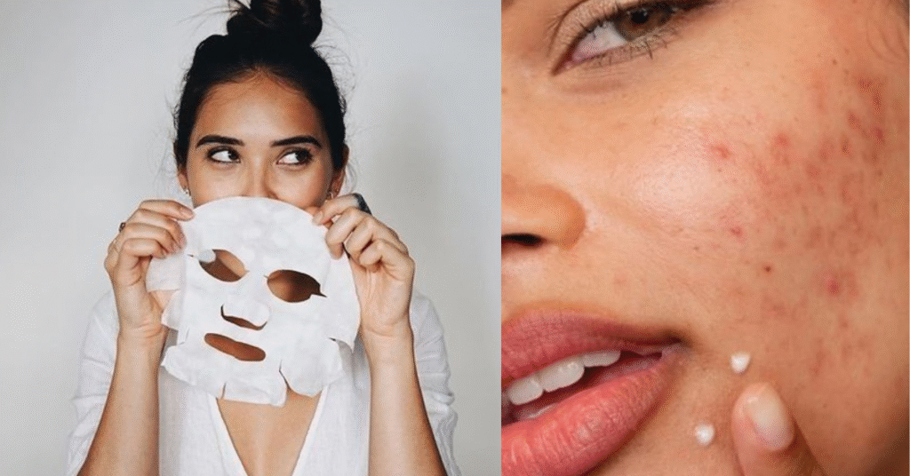 A Rotina de Skincare de 3 Passos que Finalmente Resolveu Minha Pele com Acne.